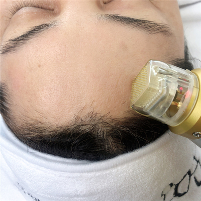 Colagênio que remodela o dispositivo RF fracionário de Microneedling para a gestão facial