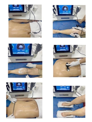 Máquina portátil da terapia de Tecar da inquietação do EMS do vácuo para o tratamento facial/deficiência orgânica eréctil/alívio das dores/reabilitação