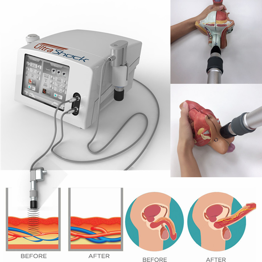 Máquina da fisioterapia do ultrassom da inquietação para o alívio das dores do corpo